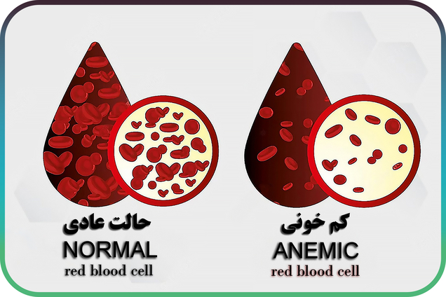 مهمترین علائم کم خونی کدام است؟